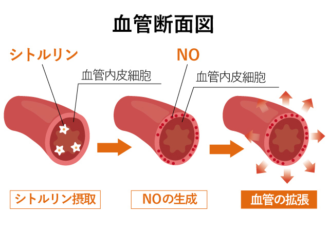 血管断面図